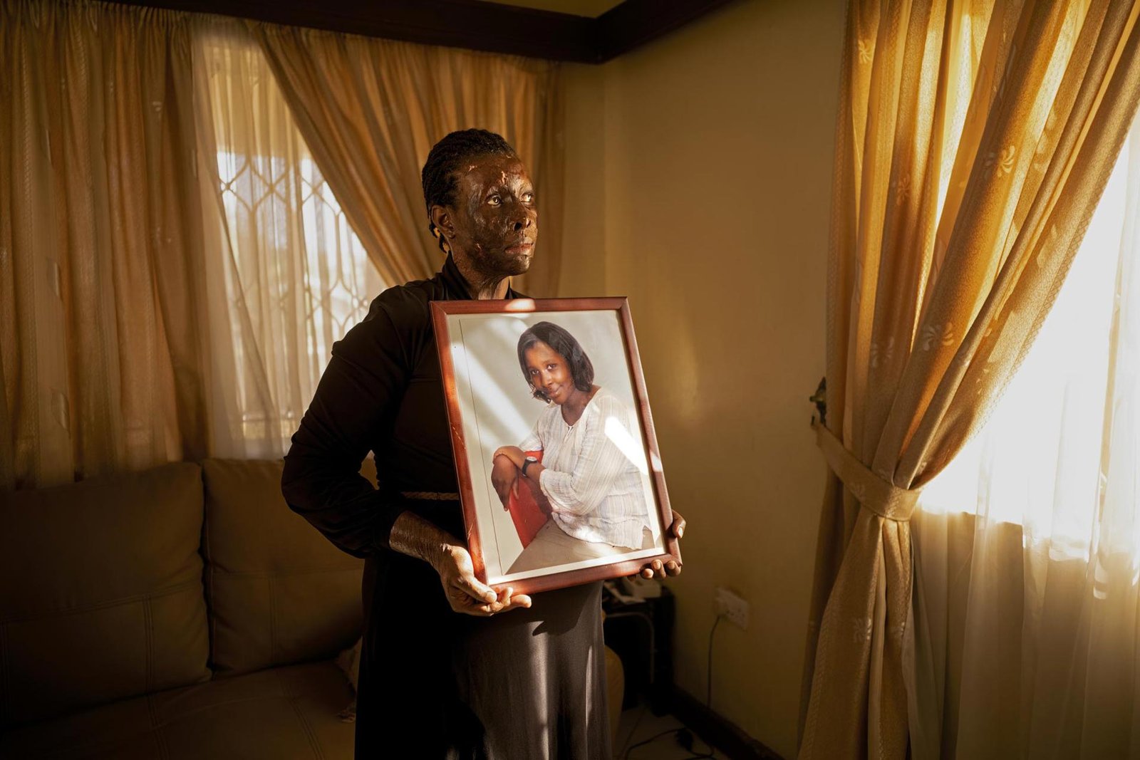 Acid violence against women in Uganda | 2023